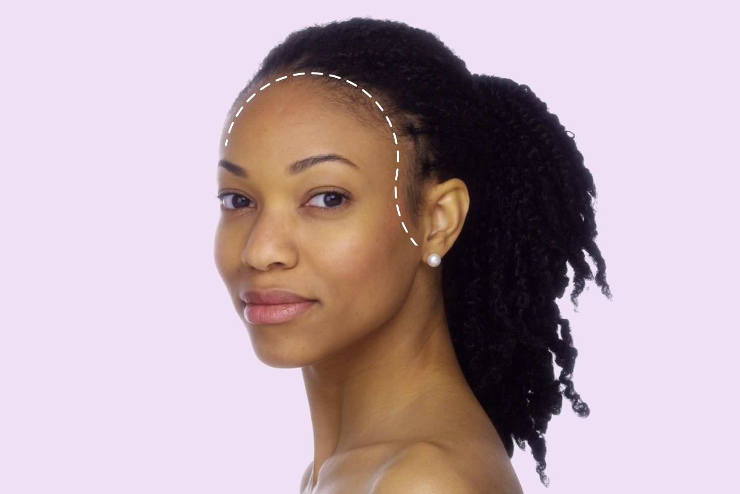 How to Grow Edges Back Naturally and Boost A Thinning Hairline