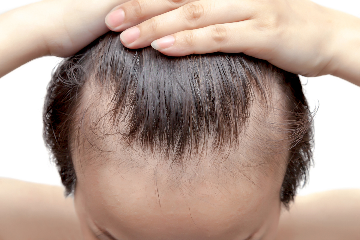 edges thinning causes and reasons