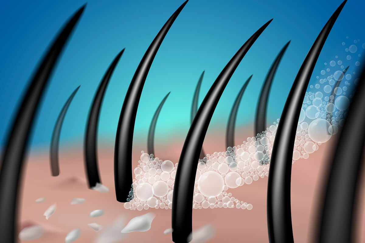 use a clarifying shampoo to promote healthy hair care routine Can clarifying shampoo fix dandruff problems and oily hair