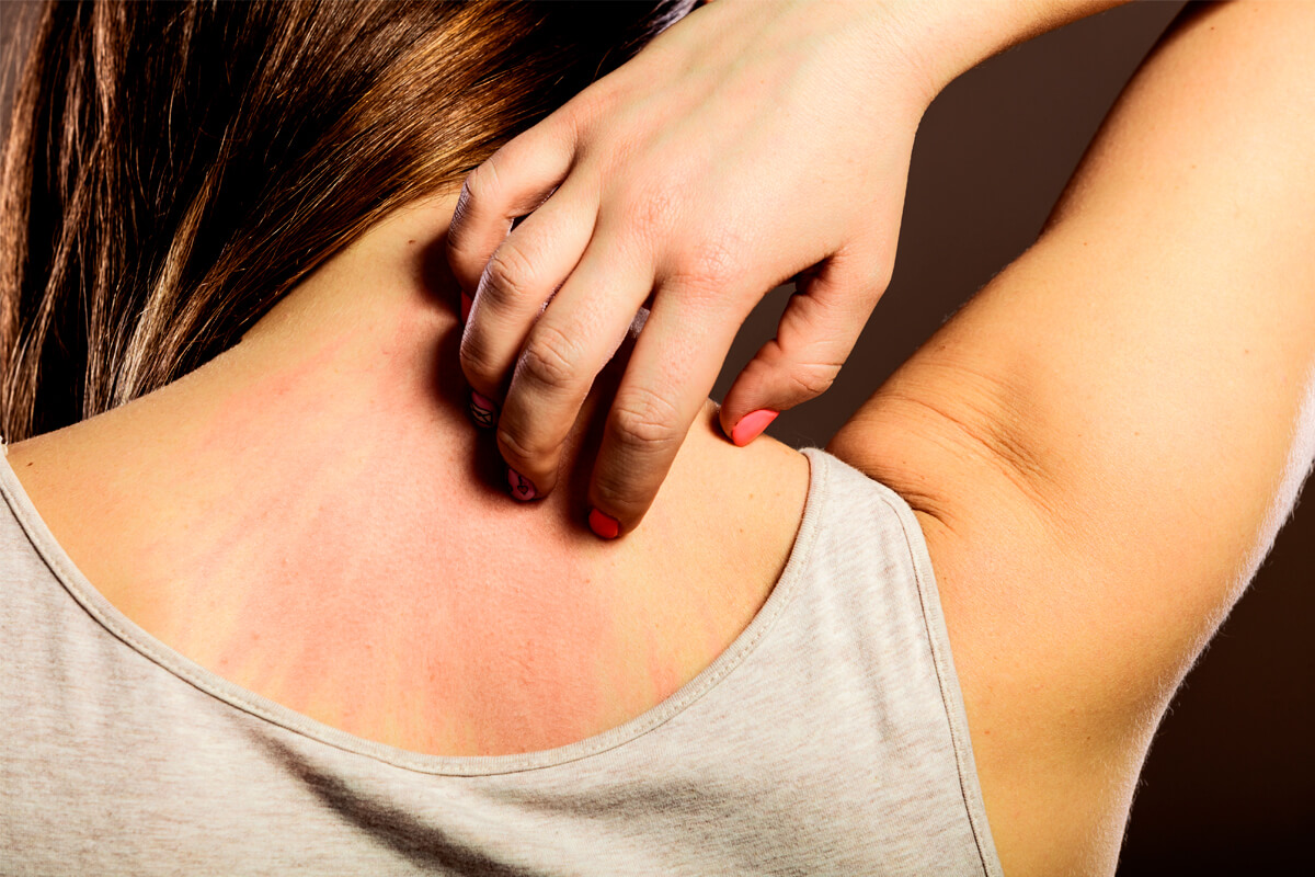 allergic reaction to keratin treatment can keratin treatment cause allergies