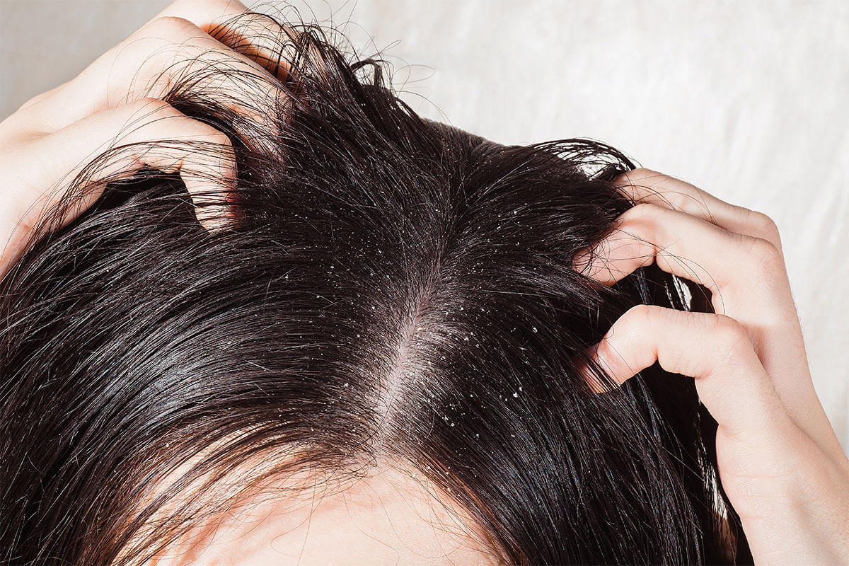 buildup blocking moisture on the hair shaft product build-up on hair shaft