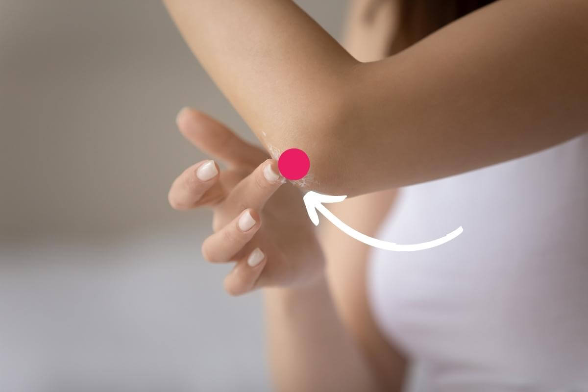 elbow allergy test