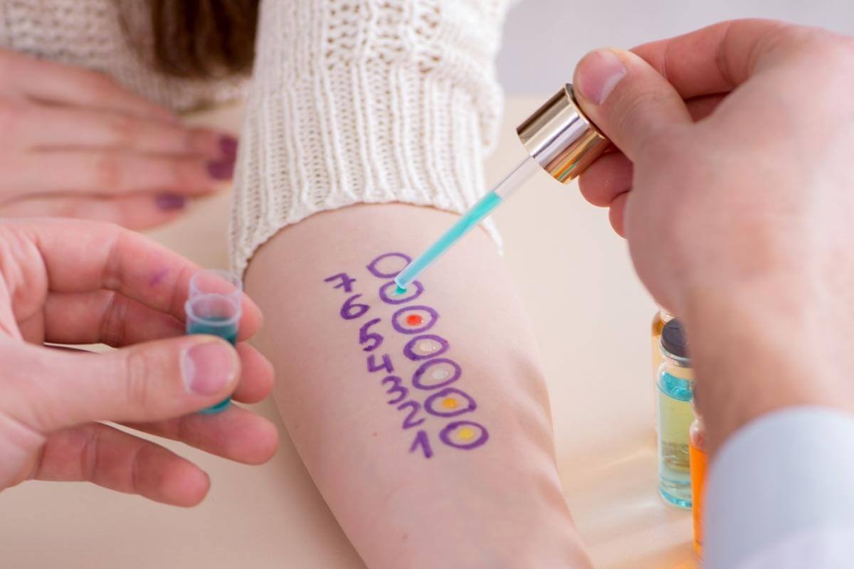 patch test illustration patch test definition