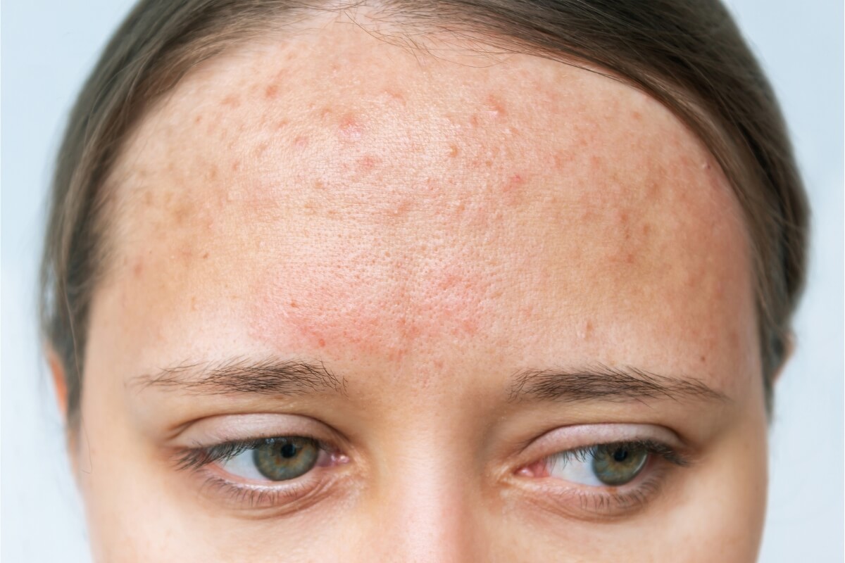 safest semi permanent hair color safest hair dye for thinning hair